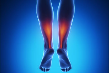 Achilles Tendon Treatment in the in the Manatee County, FL: Bradenton (University Park, Bayshore Gardens, Palmetto, Foxleigh, Lakewood Ranch, Ellenton, Parrish) and Sarasota County, FL: Sarasota (South Gate Ridge, Sarasota Springs, Venice, Laurel, Osprey, Fruitville, South Sarasota, North Sarasota, Southgate, Bee Ridge) areas