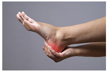 Heel pain treatment in the Manatee County, FL: Bradenton (University Park, Bayshore Gardens, Palmetto, Foxleigh, Lakewood Ranch, Ellenton, Parrish) and Sarasota County, FL: Sarasota (South Gate Ridge, Sarasota Springs, Venice, Laurel, Osprey, Fruitville, South Sarasota, North Sarasota, Southgate, Bee Ridge) areas